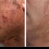 لک و التهاب‌های عجیب پوستت تکرار می‌شن|خوردنی و آشامیدنی|تهران, یوسف‌آباد|دیوار