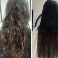 انجام موخوره گیری در منزل یا سالن