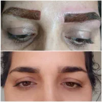 خدمات رایگان ریموو