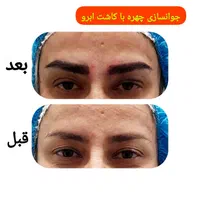 کاشت ابرو دائمی و قابل رشدVIP/جراحی و غیرجراحی|خدمات آرایشگری و زیبایی|اراک, |دیوار