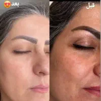 کرم بیوممتیک ضدلک نمایندگی شریف آبادخریدحضوری|آرایشی، بهداشتی، درمانی|تهران, حسنآباد|دیوار