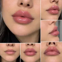 تزریق فیلر،بادی ،جوانساز،سفیدی بیکینی جراحی زیبایی