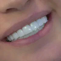 کامپوزیت زیبایی دندان پزشکی|خدمات آرایشگری و زیبایی|یاسوج, |دیوار