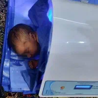 اجاره دستگاه زردی نوزاد(نمایندگی مرکزی فردیس)|خدمات آرایشگری و زیبایی|فردیس, فردیس|دیوار