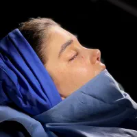 عمل جراحی بینی۲۳تا۲۷/مشاوره رایگان/لیفت صورت