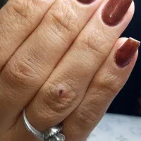 کاشت ۱۵۰تا۲۰۰|خدمات آرایشگری و زیبایی|نیشابور, امام|دیوار