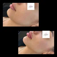 آف ویژه کلیه خدمات تا ۲۰دی ماه بدون افزایش قیمت