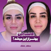 جشنواره عیدتاعید(کاشتمووابرو)۲۲/۳میلیون تضمینکتبی