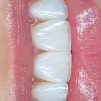 دستیار دندانپزشک خانم