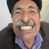 دندان مصنوعی از دم قسط|خدمات آرایشگری و زیبایی|اصفهان, شیخ طوسی|دیوار