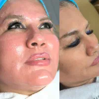 آموزش و اجرا تکنیک گلس اسکین (پوست شیشه ای)