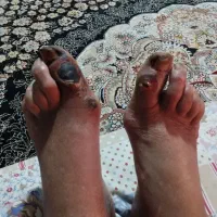 درمان ریشه ای دیابت قطع قرص و انسولین|خدمات آرایشگری و زیبایی|قشم, |دیوار
