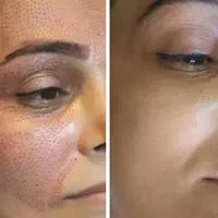 جشنواره زیبایی پاییزه از الان تا آخررآذر ماه