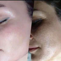 روشن کننده و سفید کننده فوری پوست وایت رز پلاس اصل