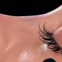 تخفیف ویژه عمل بینی