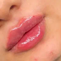 مدل ژل لب و چونه و زاویه فک جهت عکاسی سیسی990