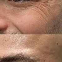 فرصت استثنایی زیبایی و لاغری، تخفیف به مدت محدود|خدمات آرایشگری و زیبایی|اهواز, کیانپارس |دیوار