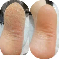 تخفیف ویژه روز مادرو یلدا فشیال دست وپاو صورت|خدمات آرایشگری و زیبایی|اصفهان, گرکان|دیوار