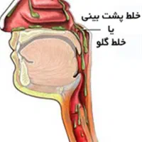 وداع با خلط با قدرت طبیعت