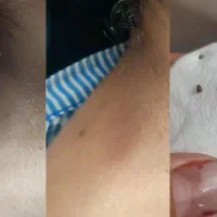 پاکسازی و تمام خدمات پوستی