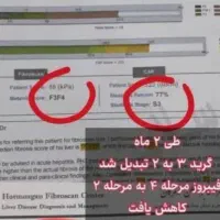 درمان تضمینی کبدجرب بامحصولات گیاهی شرکت کاژان|خوردنی و آشامیدنی|رباط‌کریم, شهرک صنعتی نصیرآباد|دیوار