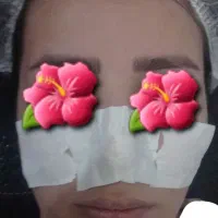 فیشال تخصصی باتخفیف ویژه به صورت اقساطی