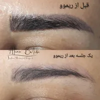 خدمات و آموزش تخصصی ریموو تتو تک جلسه ای،تتو بدن|خدمات آرایشگری و زیبایی|رشت, گلسار|دیوار