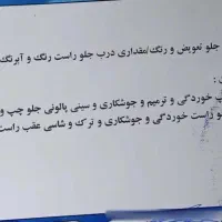 وانت پیکان