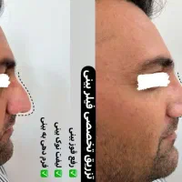 *جشنواره * تخفیف کلینیک زیبایی|خدمات آرایشگری و زیبایی|قرچک, شهرک طلائیه|دیوار