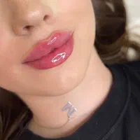 ژل بوتاکس150کلینیک پوست آموزش نخ ژل هایفو|خدمات آرایشگری و زیبایی|تهران, زعفرانیه|دیوار