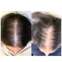 درمان ریزش مو،مژه ،ابر،وها وپو،ست|آرایشی، بهداشتی، درمانی|شیراز, شهرک نیروی انتظامی|دیوار