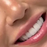 دستیار دندانپزشک