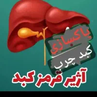 کبدچرب وسیروز