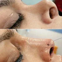 عمل بینی/پلک/غبغب/بوتاکس/پیکرتراشی