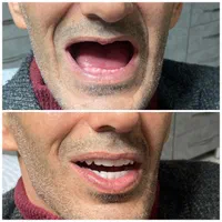 دندان مصنوعی لبخند (ضمانت ۱۰ ساله/تحویل ۳تا ۷ روز)|خدمات آرایشگری و زیبایی|کرج, اصفهانیها|دیوار