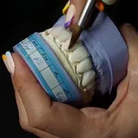 آموزش دندانسازی صفر تا صد و معرفی به کار