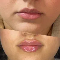 مرکز تخصصی لیزر و زیبایی لیلیا