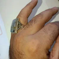 انگشتر شجر|جواهرات|کرمانشاه, |دیوار