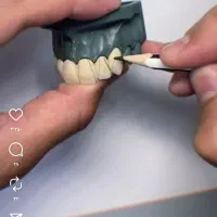 کاراموز در بخش دندان سازی