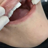 کلینیک تخصصی ایمپلنت با اقساط بلندمدت|خدمات آرایشگری و زیبایی|تهران, قیطریه|دیوار