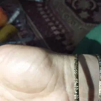 النگوسایزیک