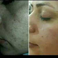 کرم معجزه شب اصل رفع لک وجوش وسفیدشدن پوست|آرایشی، بهداشتی، درمانی|قم, چهار مردان|دیوار