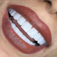 کامپوزیت کن بدون پیش پرداخت|خدمات آرایشگری و زیبایی|کرج, ساماندهی|دیوار
