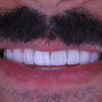 نیازمند دندانپزشک دارای پروانە طبابت