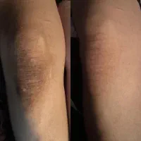 کرم روشن کننده بدن