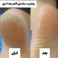 پماد|آرایشی، بهداشتی، درمانی|اهواز, عین ۲|دیوار