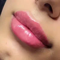 لیزر مو زائد/هایفو تراپی/ژل لب/تزریق چربی/بوتاکس|خدمات آرایشگری و زیبایی|اصفهان, جلفا|دیوار