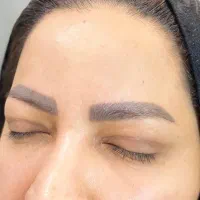 جراحی پلک با بخیه لیزری توسط جراح متخصص زیبایی|خدمات آرایشگری و زیبایی|تهران, تجریش|دیوار