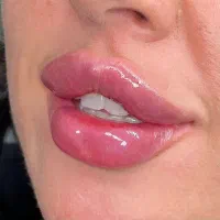 جشنواره تخفیف ویژه فیلربوتاکس انزیم وقت فوری|خدمات آرایشگری و زیبایی|کرج, گوهردشت|دیوار
