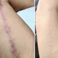 کاموفلاژ دائم|خدمات آرایشگری و زیبایی|تهران, بوستان چیتگر|دیوار